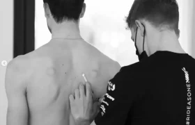 Una persona, posiblemente Giacomo Tomio, marca puntos en la espalda desnuda de otra persona con un bolígrafo mientras usa una máscara y guantes en una habitación bien iluminada.
